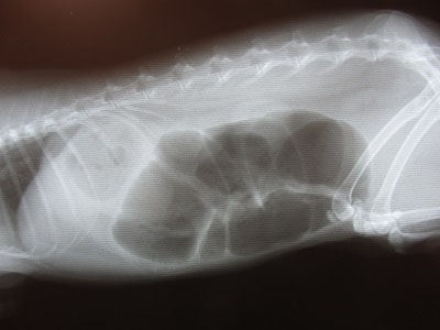 盲腸ガスのレントゲン写真
